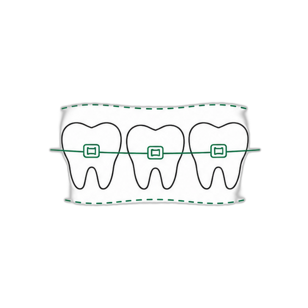 矯正歯科のイラスト